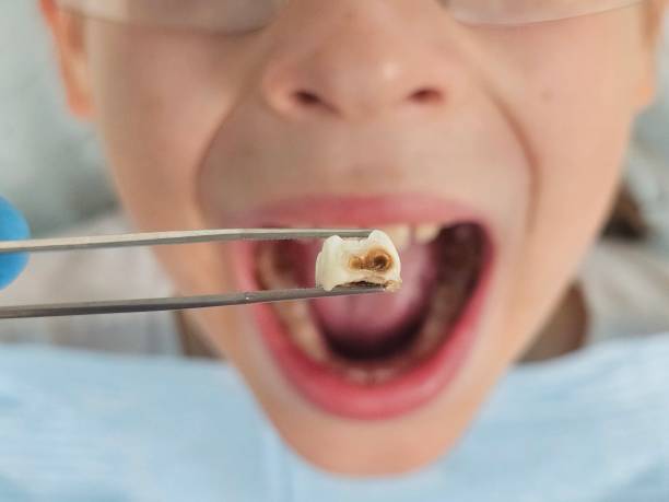 Best Pediatric Emergency Dentist in Oak Grove Heights, AR