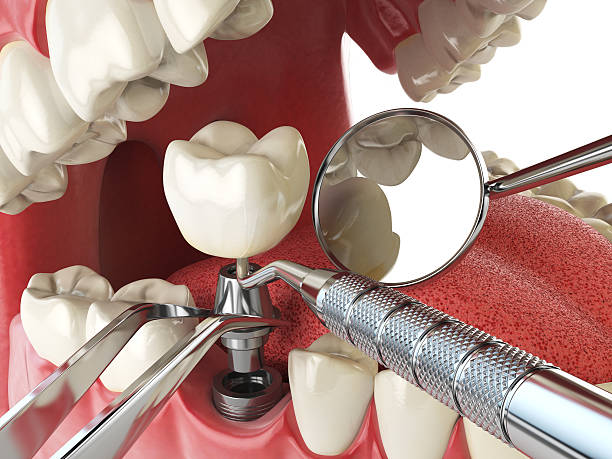 Best Emergency Dentist for Knocked-Out Tooth in Oak Grove Heights, AR